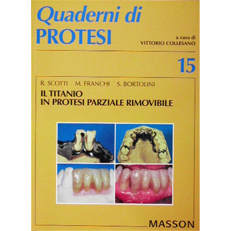 Quaderni di Protesi - 15 - II titanio in protesi parziale rimovibile